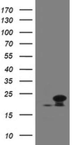 NDUFB10 Monoclonal Antibody (OTI1H6), TrueMAB , OriGene 100 &mu;L; Unconjugated:Antibodies,