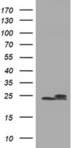 NDUFB10 Mouse anti-Human, Clone: OTI2G1, lyophilized, TrueMAB 100 &mu;g | Buy Online | OriGene | Fisher Scientific