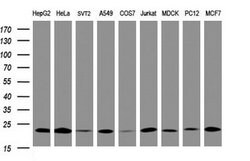 NDUFB10 Mouse anti-Human, Clone: OTI2G1, lyophilized, TrueMAB 100 &mu;g | Buy Online | OriGene | Fisher Scientific