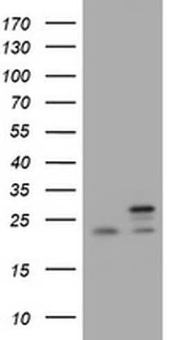 NDUFB10 Monoclonal Antibody (OTI4D1), TrueMAB , OriGene 100 &mu;L; Unconjugated:Antibodies,