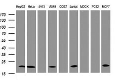 NDUFB10 Mouse anti-Human, Clone: OTI4D1, lyophilized, TrueMAB 100 &mu;g;