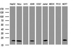 NDUFB10 Monoclonal Antibody (OTI4D1), TrueMAB , OriGene 100 &mu;L; Unconjugated:Antibodies,