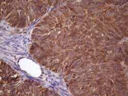 NDUFB11 Monoclonal Antibody (OTI9C5), TrueMAB , OriGene 100 &mu;L; Unconjugated:Antibodies,