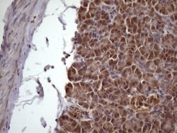NDUFB11 Monoclonal Antibody (OTI9C5), TrueMAB , OriGene 100 &mu;L; Unconjugated:Antibodies,