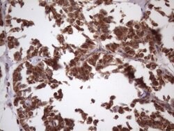 NDUFB11 Monoclonal Antibody (OTI9C5), TrueMAB , OriGene 100 &mu;L; Unconjugated:Antibodies,