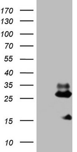 NDUFB11 Mouse anti-Human, Clone: OTI5B4, lyophilized, TrueMAB 100 &mu;g;