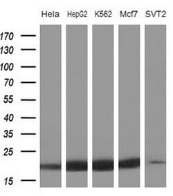 NDUFB11 Mouse anti-Human, Clone: OTI5B4, lyophilized, TrueMAB 100 &mu;g;