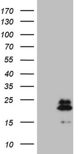 NDUFB11 Monoclonal Antibody (OTI9C5), TrueMAB , OriGene 100 &mu;L; Unconjugated:Antibodies,