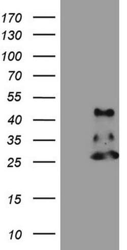 NDUFB11 Monoclonal Antibody (OTI8C5), TrueMAB , OriGene:Antibodies:Primary