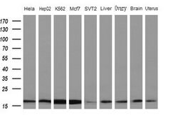 NDUFB11 Monoclonal Antibody (OTI8C5), TrueMAB , OriGene:Antibodies:Primary