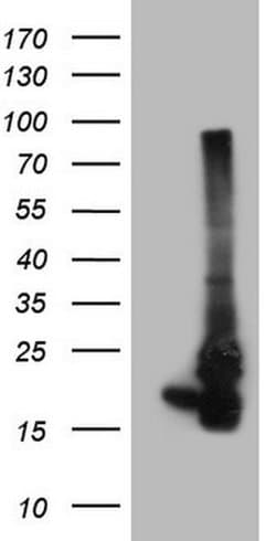 NDUFB11 Monoclonal Antibody (OTI2E10), TrueMAB , OriGene 30 &mu;L; Unconjugated:Antibodies,