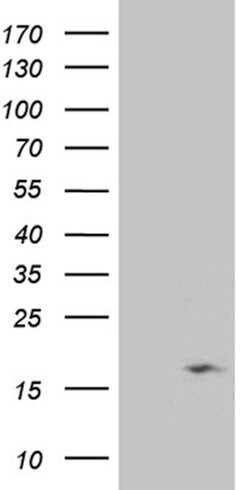 NDUFB3 Mouse anti-Human, Clone: OTI2G5, lyophilized, TrueMAB 100 &mu;g;