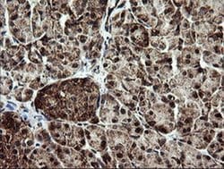 NDUFB9 Monoclonal Antibody (OTI3A1), TrueMAB , OriGene 100 &mu;L; Unconjugated:Antibodies,