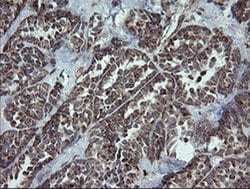 NDUFB9 Monoclonal Antibody (OTI3A1), TrueMAB , OriGene 100 &mu;L; Unconjugated:Antibodies,