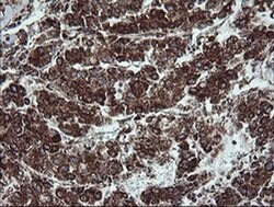 NDUFB9 Monoclonal Antibody (OTI3A1), TrueMAB , OriGene 100 &mu;L; Unconjugated:Antibodies,