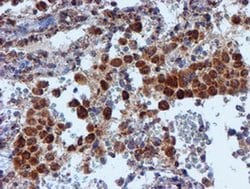 NDUFB9 Monoclonal Antibody (OTI13H11), TrueMAB , OriGene 30 &mu;L; Unconjugated:Antibodies,