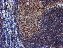 NDUFB9 Monoclonal Antibody (OTI13H11), TrueMAB , OriGene 30 &mu;L; Unconjugated:Antibodies,
