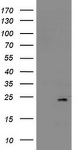 NDUFB9 Monoclonal Antibody (OTI4F8), TrueMAB , OriGene 30 &mu;L; Unconjugated:Antibodies,