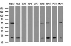 NDUFB9 Monoclonal Antibody (OTI4F8), TrueMAB , OriGene:Antibodies:Primary