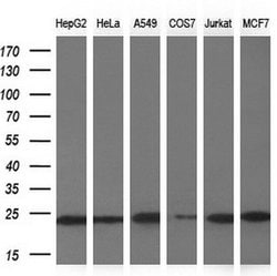 NDUFB9 Monoclonal Antibody (OTI13H11), TrueMAB , OriGene 30 &mu;L; Unconjugated:Antibodies,