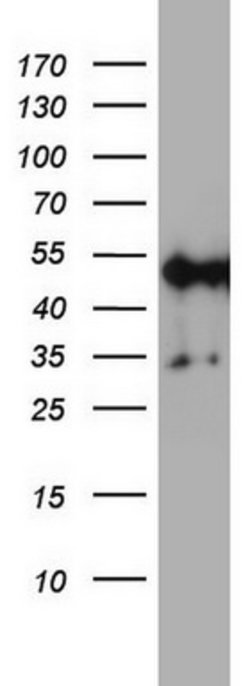 NDUFS2 Mouse anti-Human, Clone: OTI1D5, lyophilized, TrueMAB 100 &mu;g;