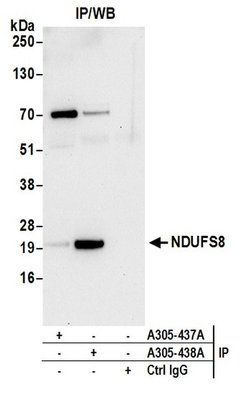 NDUFS8 Rabbit anti-Human, Polyclonal, Bethyl Laboratories 100 &mu;L; Unconjugated:Antibodies,
