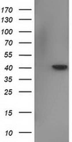 NECAB1 Monoclonal Antibody (OTI1H5), TrueMAB , OriGene 100 &mu;L; Unconjugated:Antibodies,