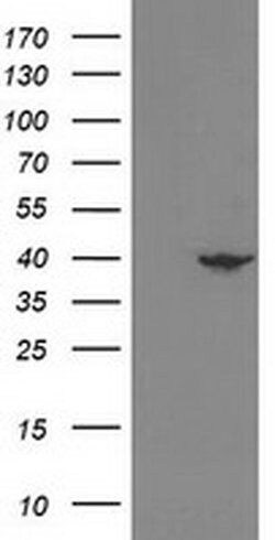 NECAB1 Monoclonal Antibody (OTI4G8), TrueMAB , OriGene 30 &mu;L; Unconjugated:Antibodies,
