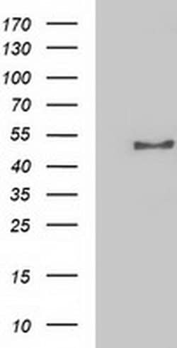 NECAB1 Monoclonal Antibody (OTI2H5), TrueMAB , OriGene 30 μL; Unconjugated:Antibodies,
