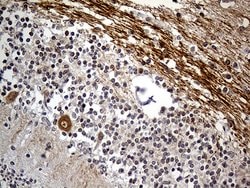 NEFH Monoclonal Antibody (OTI6F11), TrueMAB , OriGene:Antibodies:Primary