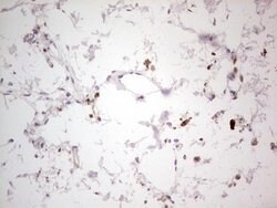 NEFM Monoclonal Antibody (OTI2G3), TrueMAB , OriGene 100 &mu;L; Unconjugated:Antibodies,