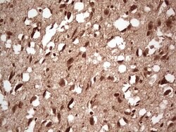 NEFM Mouse anti-Human, Clone: OTI2G3, lyophilized, TrueMAB 100 &mu;g; Unconjugated:Antibodies,