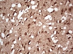 NEFM Monoclonal Antibody (OTI2G3), TrueMAB , OriGene 100 &mu;L; Unconjugated:Antibodies,