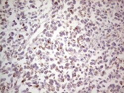 NEFM Mouse anti-Human, Clone: OTI2G3, lyophilized, TrueMAB 100 &mu;g; Unconjugated:Antibodies,