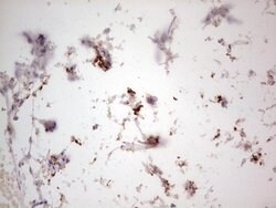 NEFM Mouse anti-Human, Clone: OTI2G3, lyophilized, TrueMAB 100 &mu;g; Unconjugated:Antibodies,