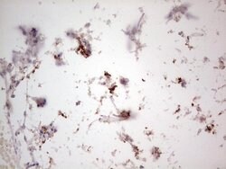NEFM Monoclonal Antibody (OTI2G3), TrueMAB , OriGene 100 &mu;L; Unconjugated:Antibodies,