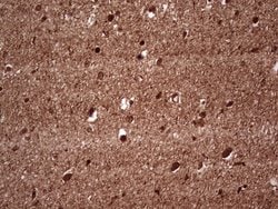 NEFM Mouse anti-Human, Clone: OTI2G3, lyophilized, TrueMAB 100 &mu;g; Unconjugated:Antibodies,