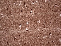 NEFM Monoclonal Antibody (OTI2G3), TrueMAB , OriGene 100 &mu;L; Unconjugated:Antibodies,