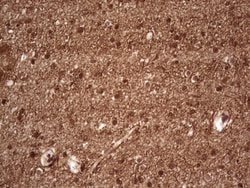 NEFM Mouse anti-Human, Clone: OTI2G3, lyophilized, TrueMAB 100 &mu;g; Unconjugated:Antibodies,