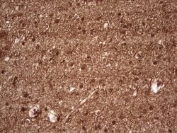 NEFM Monoclonal Antibody (OTI2G3), TrueMAB , OriGene 100 &mu;L; Unconjugated:Antibodies,