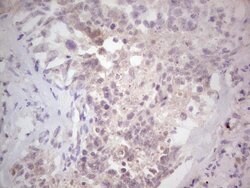 NEFM Mouse anti-Human, Clone: OTI2G3, lyophilized, TrueMAB 100 &mu;g; Unconjugated:Antibodies,