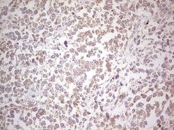 NEFM Monoclonal Antibody (OTI5B7), TrueMAB , OriGene 100 &mu;L; Unconjugated:Antibodies,