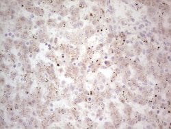 NEFM Monoclonal Antibody (OTI5B7), TrueMAB , OriGene 100 &mu;L; Unconjugated:Antibodies,