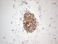 NEFM Monoclonal Antibody (OTI5B7), TrueMAB , OriGene 100 &mu;L; Unconjugated:Antibodies,