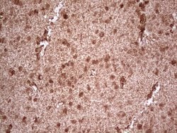 NEFM Monoclonal Antibody (OTI5B7), TrueMAB , OriGene 100 &mu;L; Unconjugated:Antibodies,
