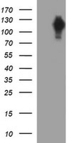 NEFM Monoclonal Antibody (OTI1A4), TrueMAB , OriGene 100 &mu;L; Unconjugated:Antibodies,