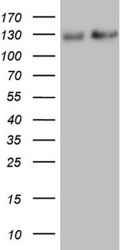NEFM Mouse anti-Human, Clone: OTI2G3, lyophilized, TrueMAB 100 &mu;g; Unconjugated:Antibodies,