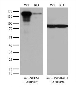 NEFM Mouse anti-Human, Clone: OTI2G3, lyophilized, TrueMAB 100 &mu;g; Unconjugated:Antibodies,