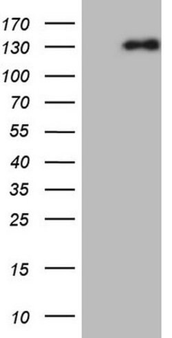 NEFM Monoclonal Antibody (OTI5B7), TrueMAB , OriGene 100 &mu;L; Unconjugated:Antibodies,