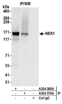 NEK1 Rabbit anti-Human, Polyclonal, Bethyl Laboratories 100 &mu;L; Unconjugated:Antibodies,